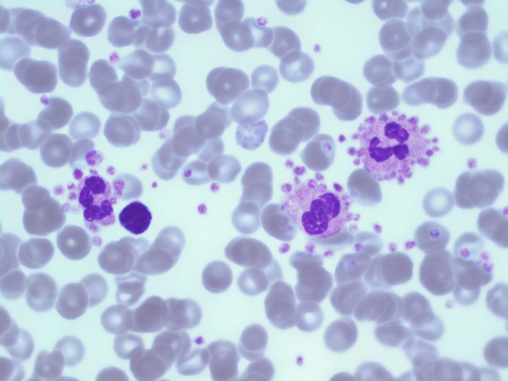 malaria platelet satellitism
