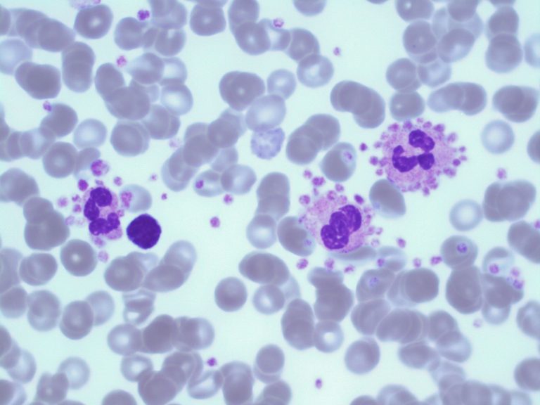 malaria platelet satellitism